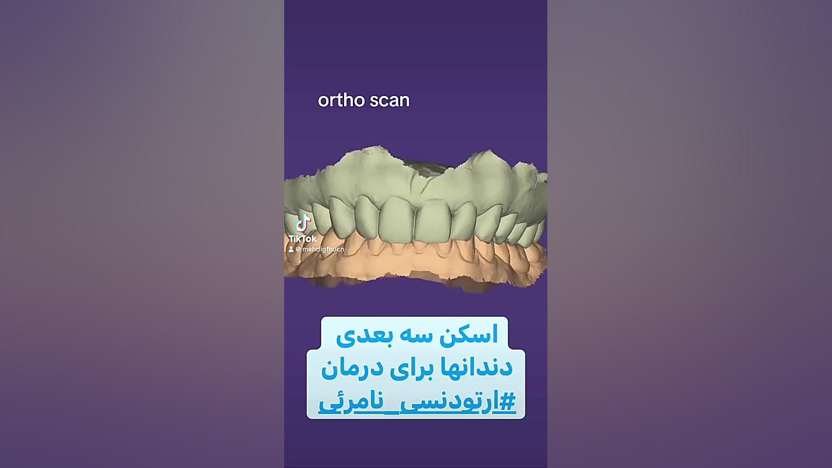 ارتودنسی شفاف غرب تهران دكتر مهدي فهيمي هنزائي