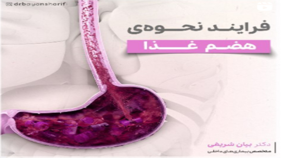فرآیند هضم غذا دکتر بیان شریفی-متخصص بیماری های داخلی