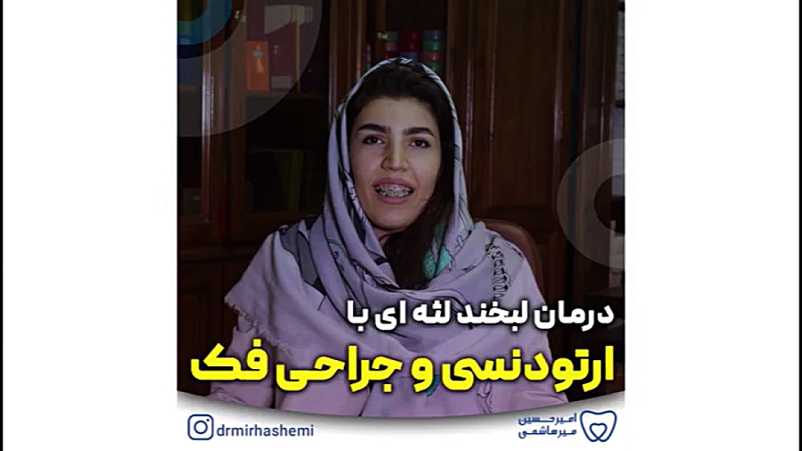 درمان لبخند لثه ای با ارتودنسی و جراحی فک هایپوفلکسی