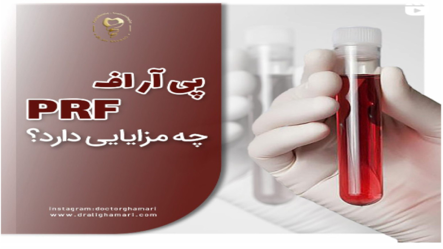مزایای پی آر اف دکتر علی قمری - متخصص جراحی لثه و ایمپلنت