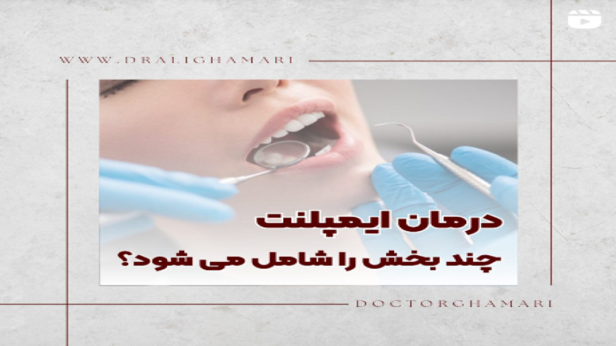 تعداد جلسات درمان ایمپلنت دکتر علی قمری - متخصص جراحی لثه و ایمپلنت