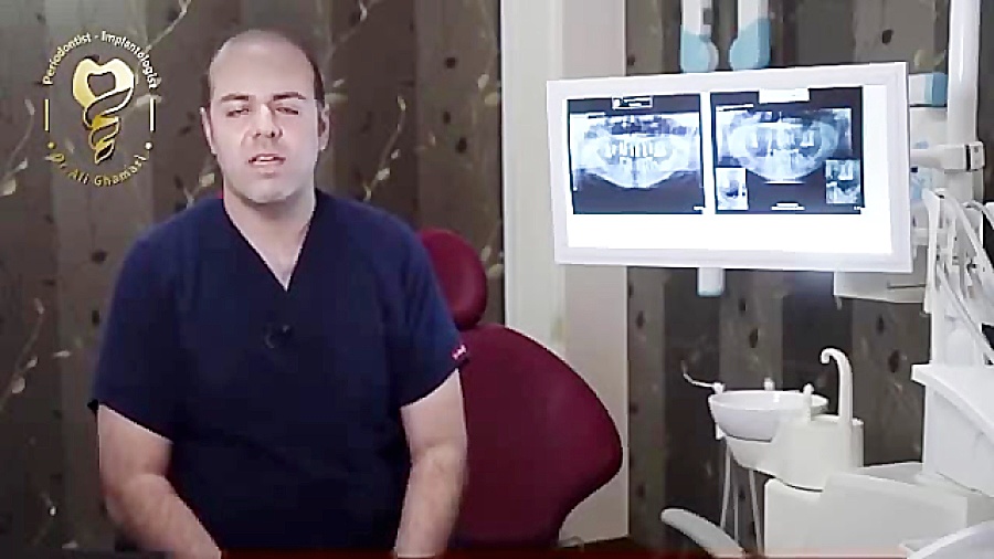 تعداد ایمپلنت مورد نیاز برای بازسازی فک دکتر علی قمری - متخصص جراحی لثه و ایمپلنت