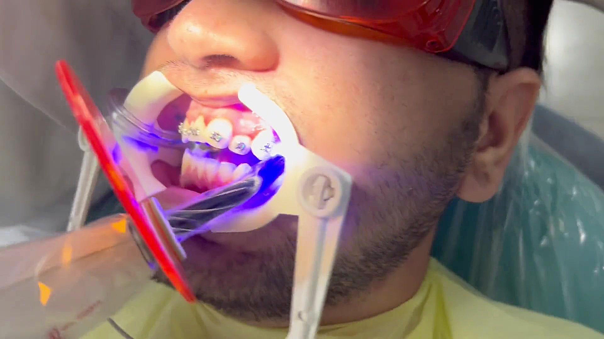 ارتودنسی تهران دكتر مهدي فهيمي هنزائي