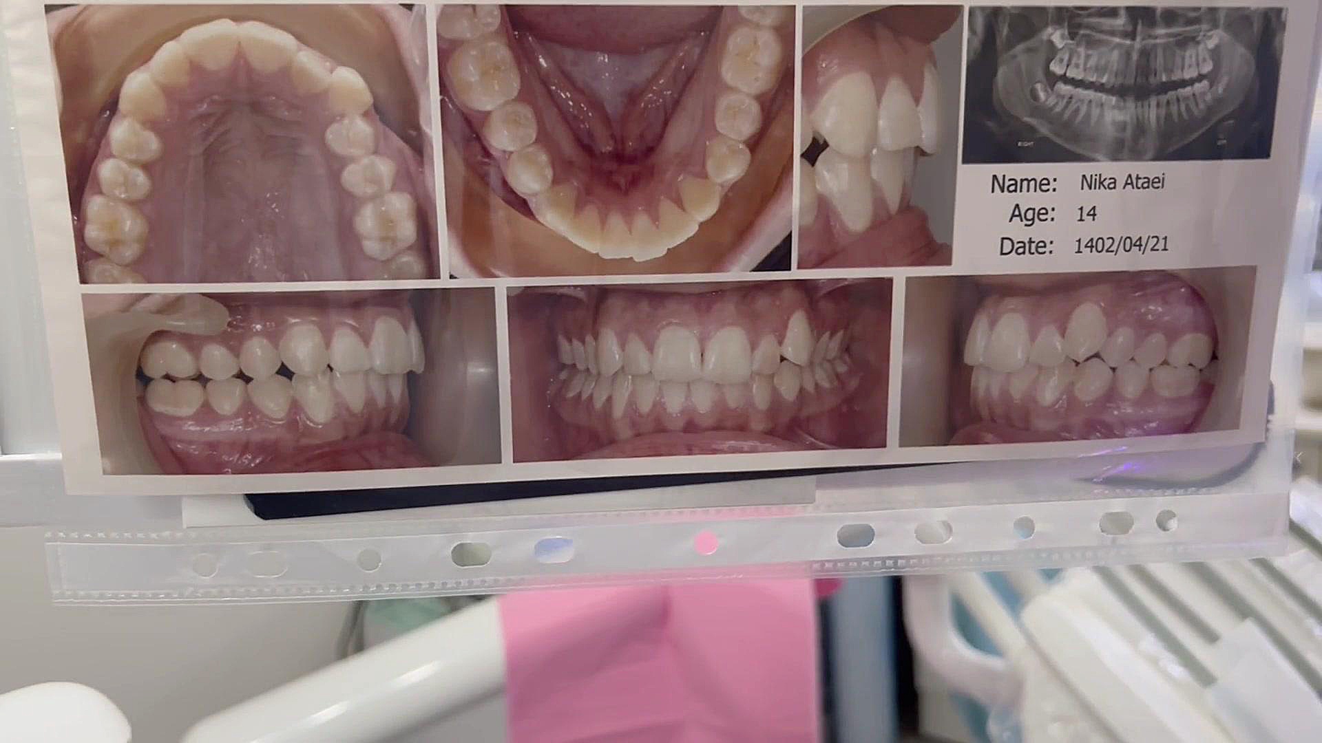 ارتودنسی دكتر مهدي فهيمي هنزائي