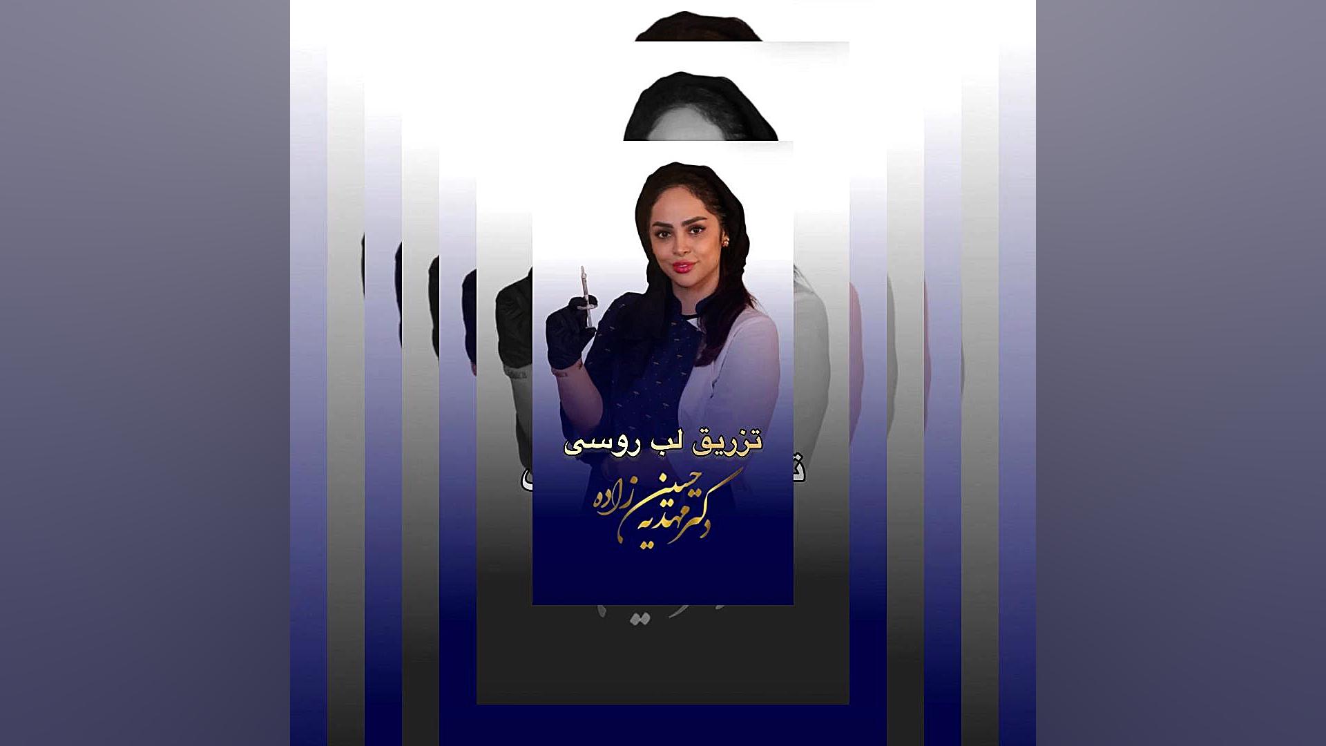 تزریق لب روسی-تزریق لب روسی در رشت-دکترمهدیه حسین زاده کلینیک زیبایی رشت دکتر مهدیه حسین زاده