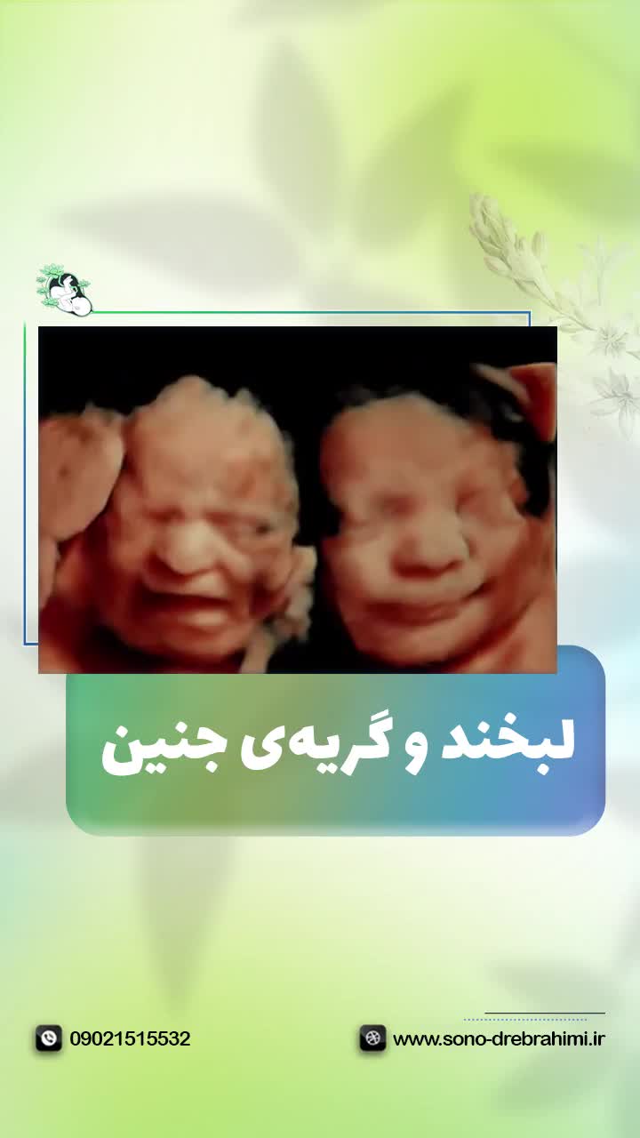 خنده و گریه ی جنین ، تصویر چهاربعدی جنین مرکز تصویربرداری دکتر مریم ابراهیمی، مبنا-تهران