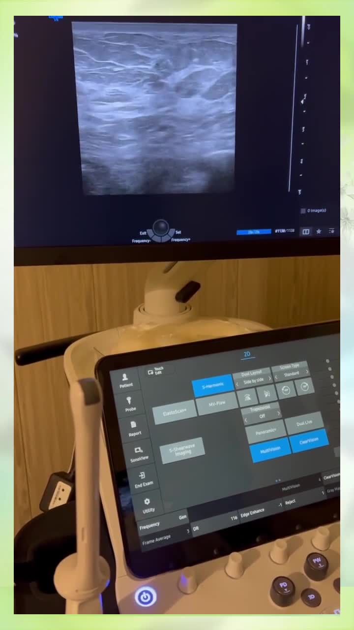 تجربه بهبود سرطان پستان مرکز تصویربرداری دکتر مریم ابراهیمی، مبنا-تهران