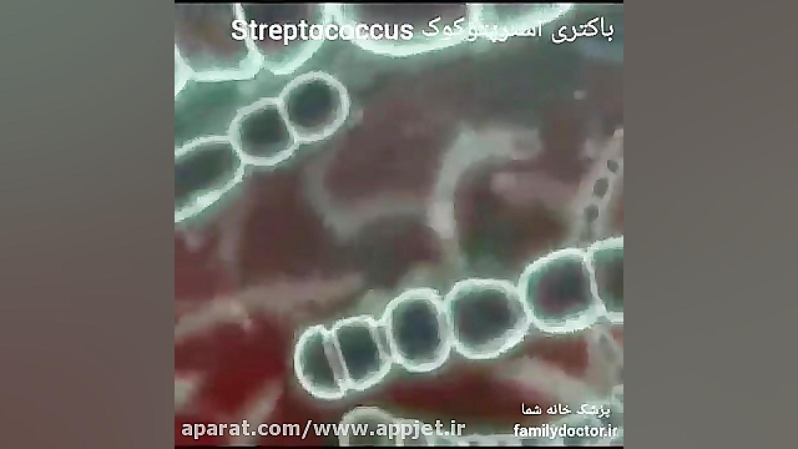 باکتری استرپتوکوک TAVI