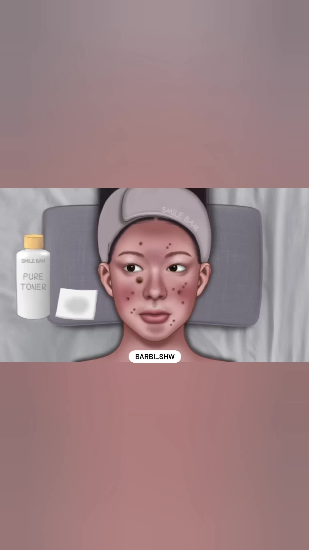 برداشتن خال صورت و فیشال پوست آزمایش ایمونوسورپشن
