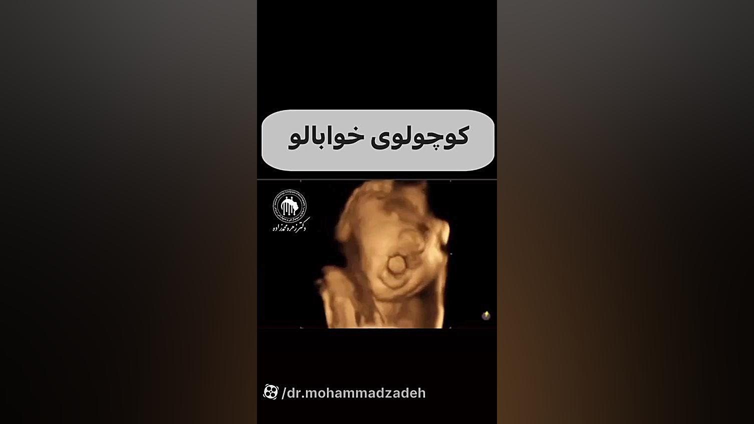 سوگرافی سه بعدی و چهار بعدی محسن یگانه