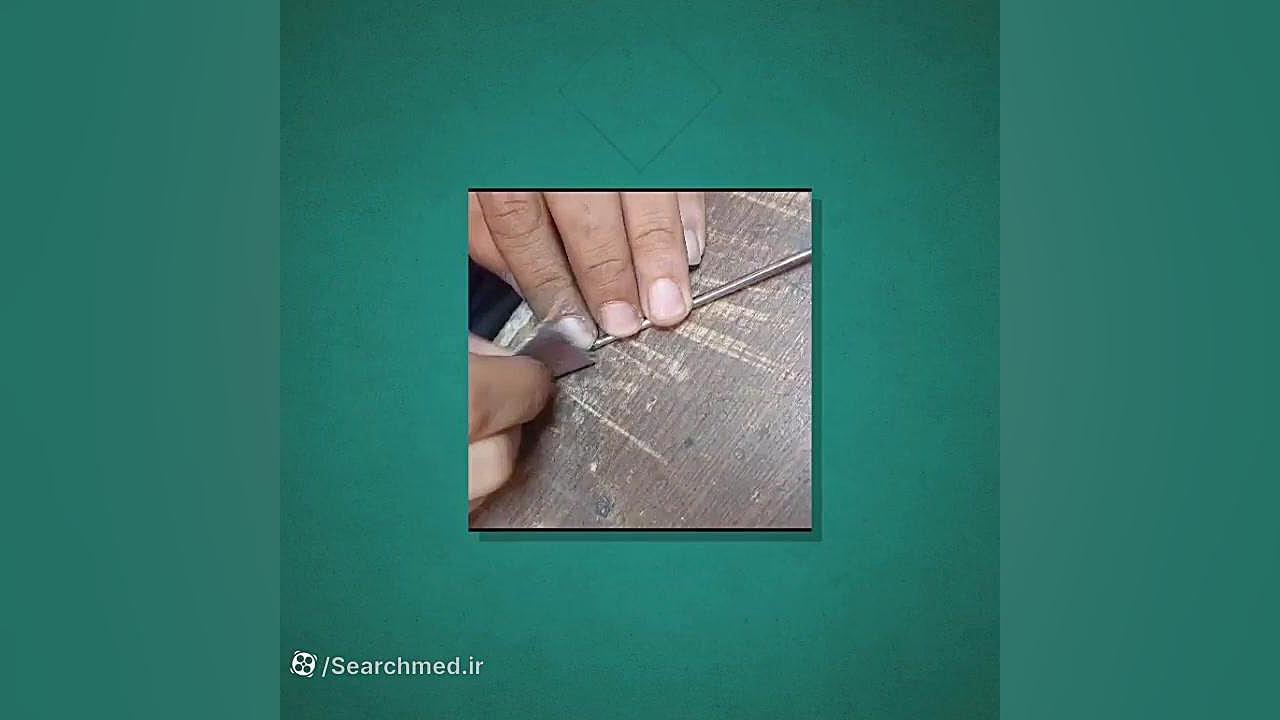 تعمیرات تخصصی ابزار جراحی تزریق چربی