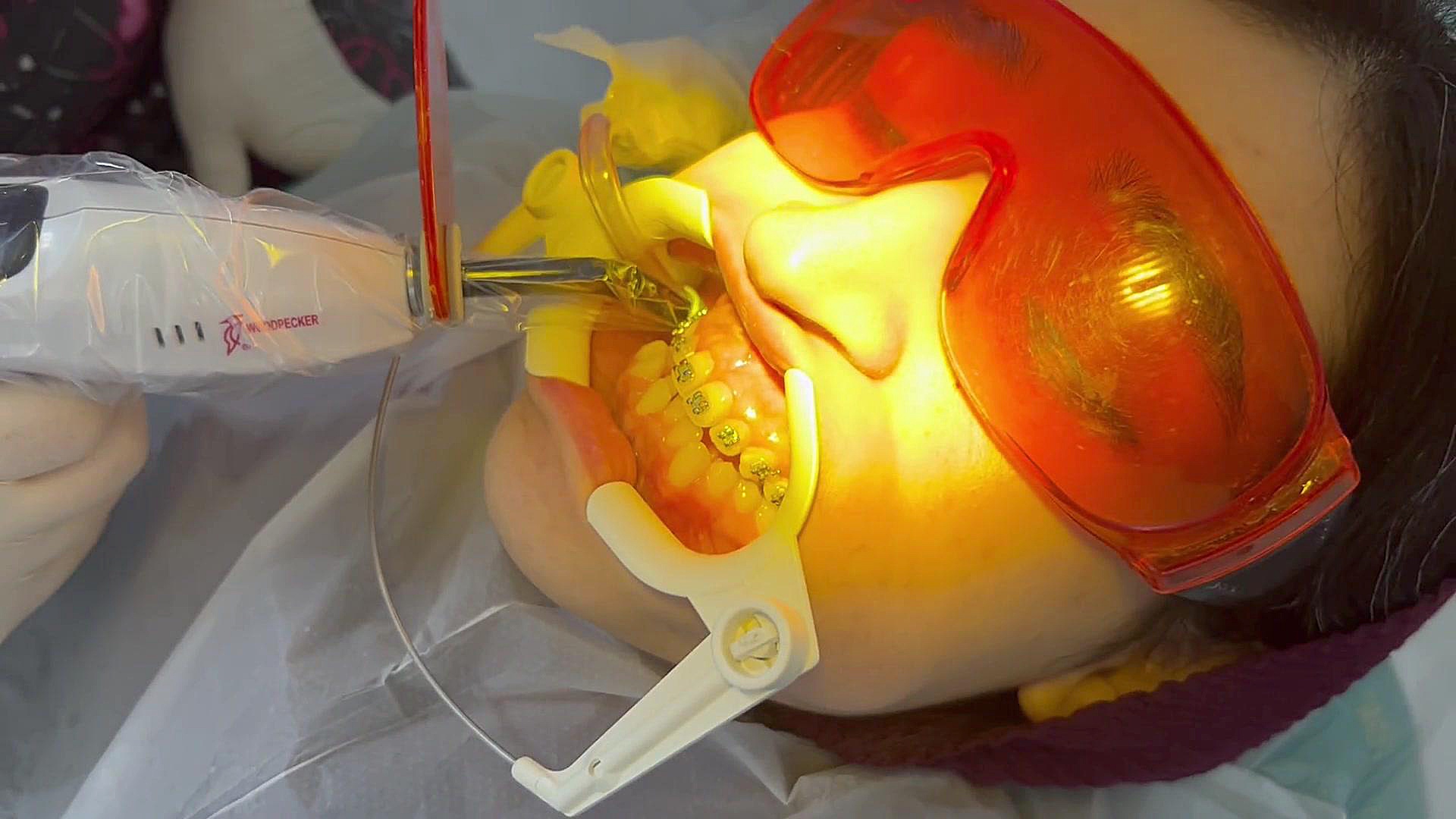 ارتودنسی دو قلوها دكتر مهدي فهيمي هنزائي