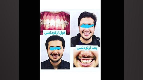 ارتودنسی تضمینی دكتر مهدي فهيمي هنزائي
