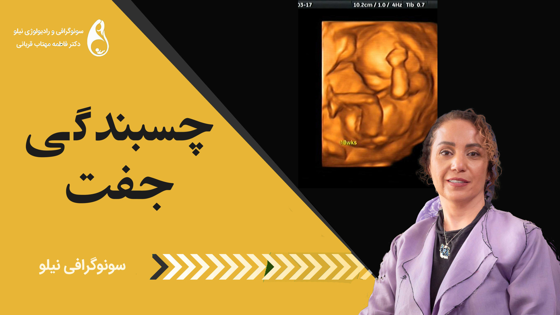 چسبندگی جفت سونوگرافی نیلو دکتر فاطمه مهتاب قربانی