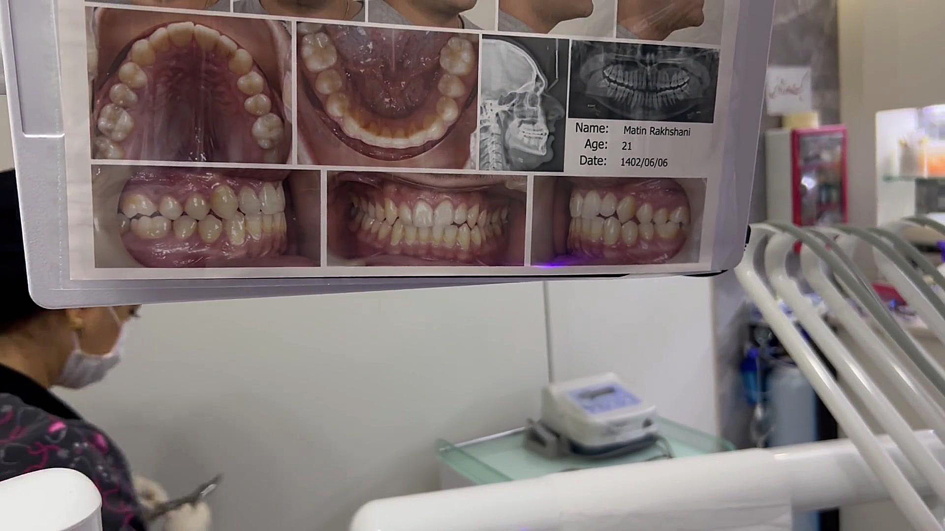 ارتودنسی در مطب خصوصی دكتر مهدي فهيمي هنزائي