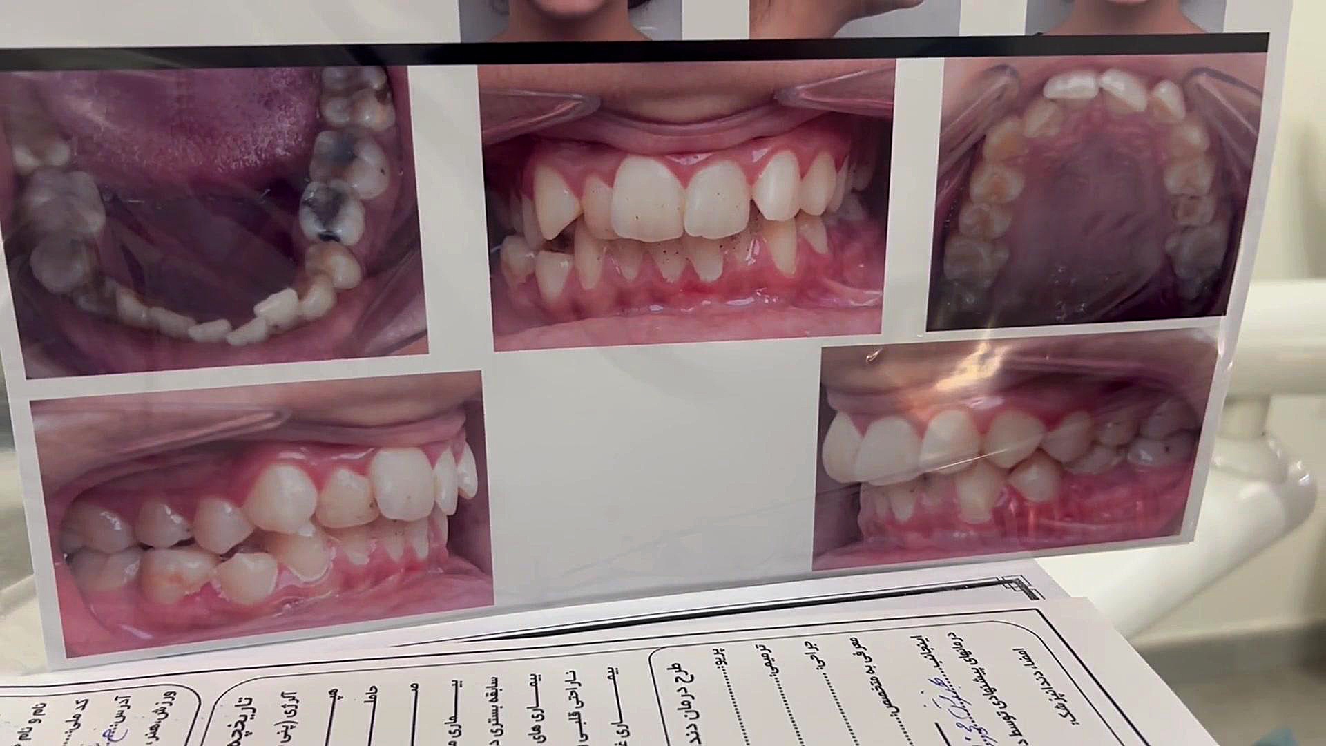 ارتودنسی شهران دكتر مهدي فهيمي هنزائي