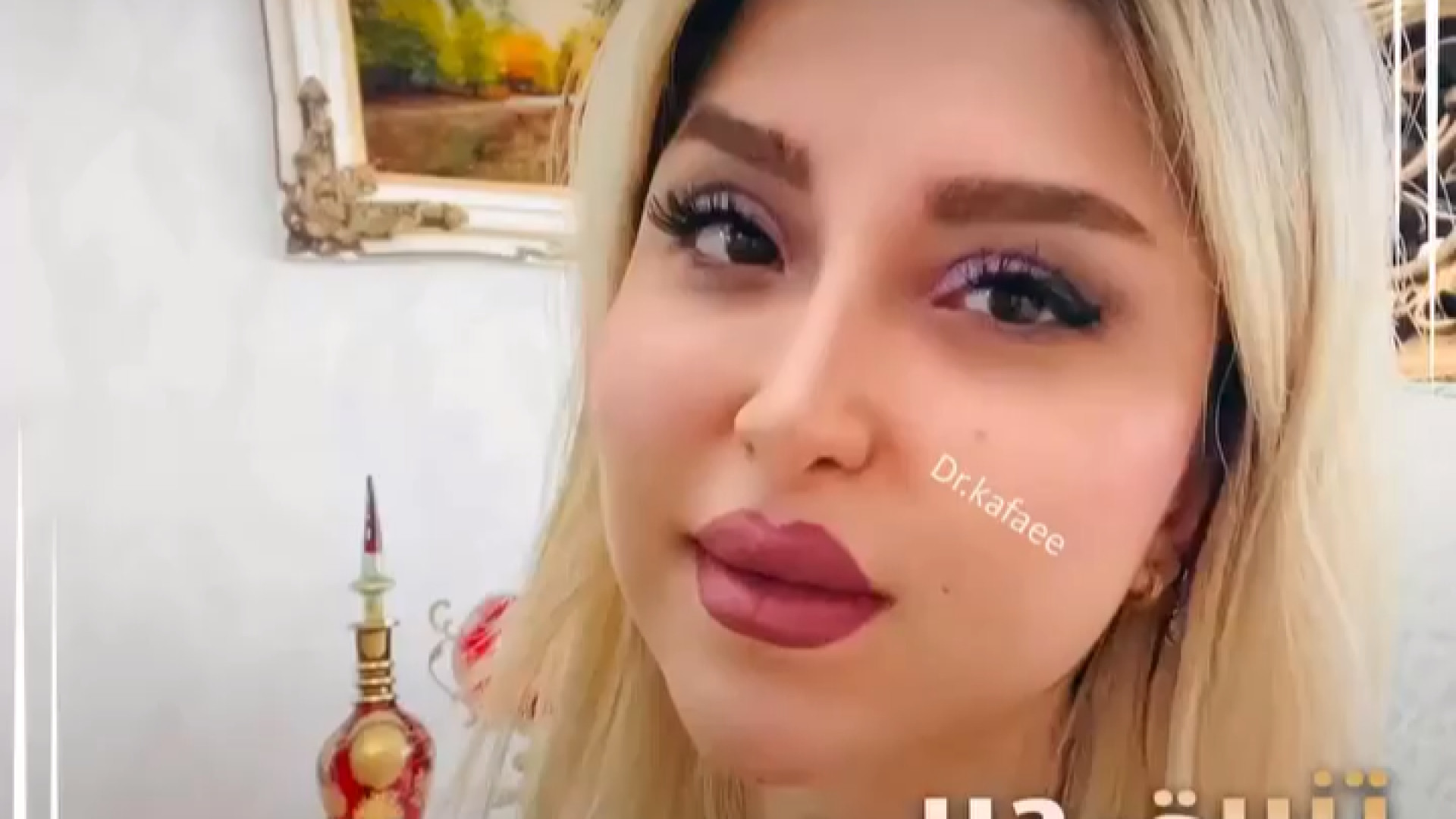 تزریق چربی به صورت | دکتر الهام کفایی پالپوتومی