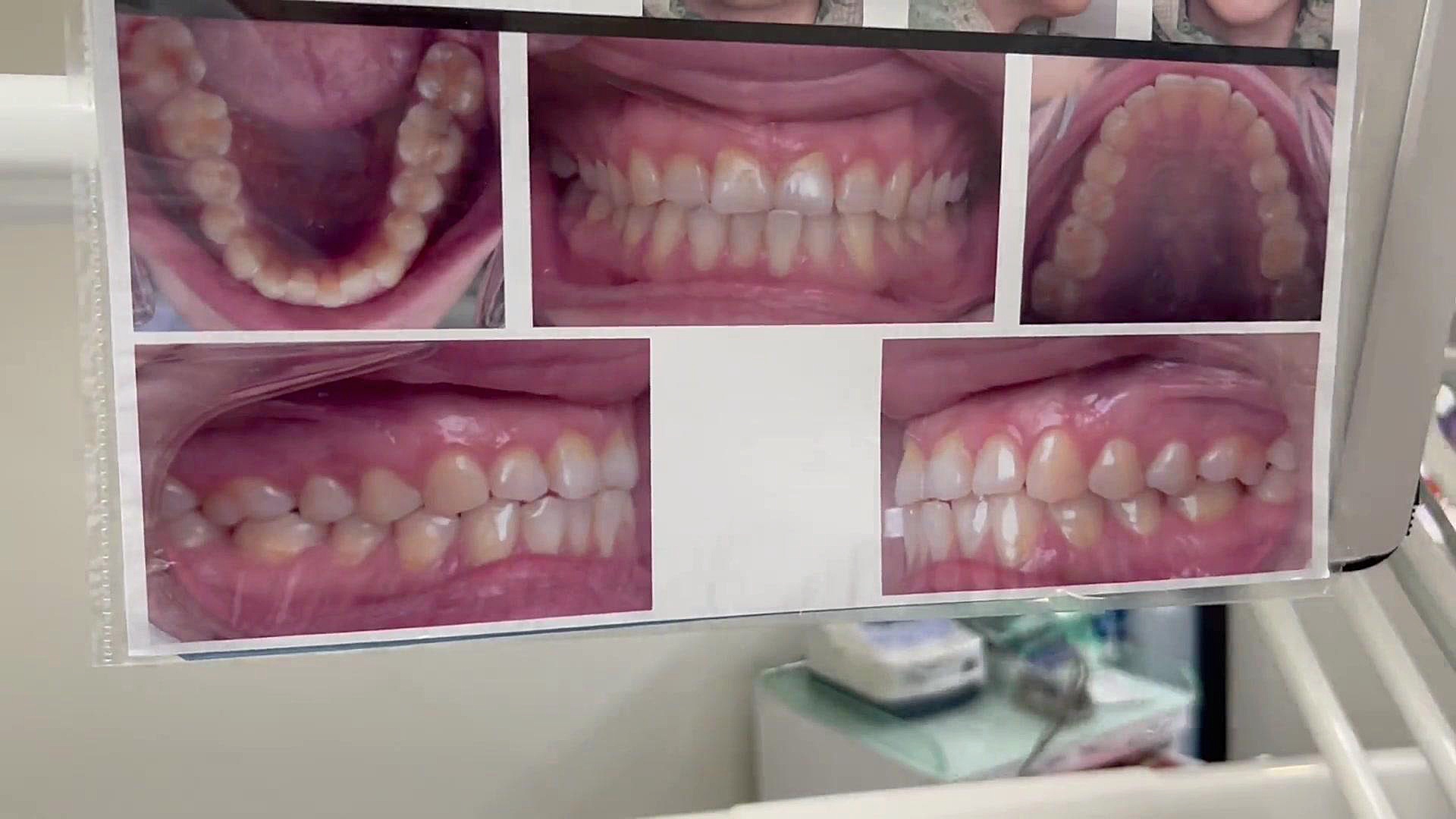 چگونه ارتودنسی را شروع کنیم دكتر مهدي فهيمي هنزائي