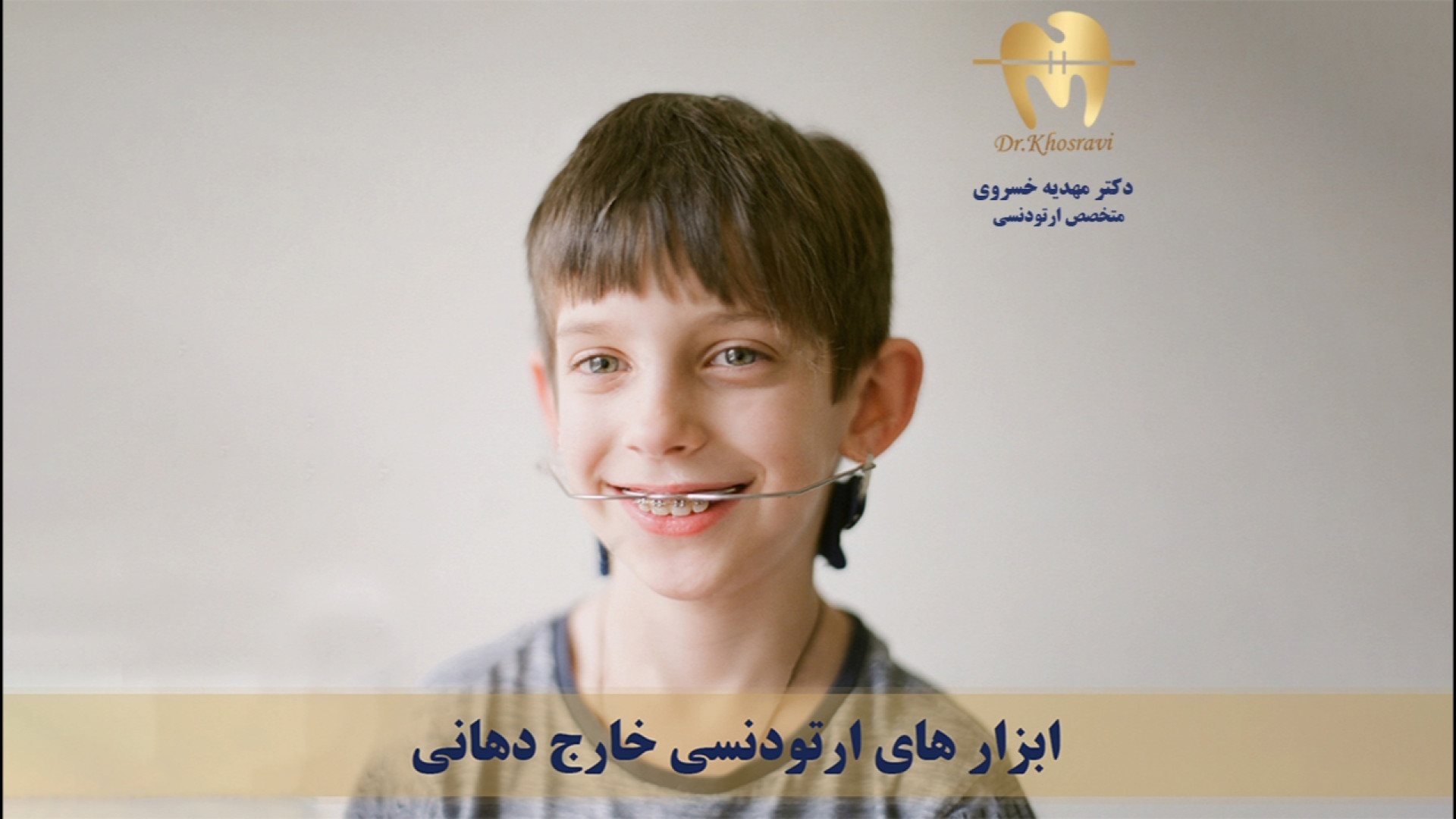 ابزار خارج دهانی - دکتر مهدیه خسروی - متخصص ارتودنسی دکتر مهدیه خسروی - متخصص ارتودنسی