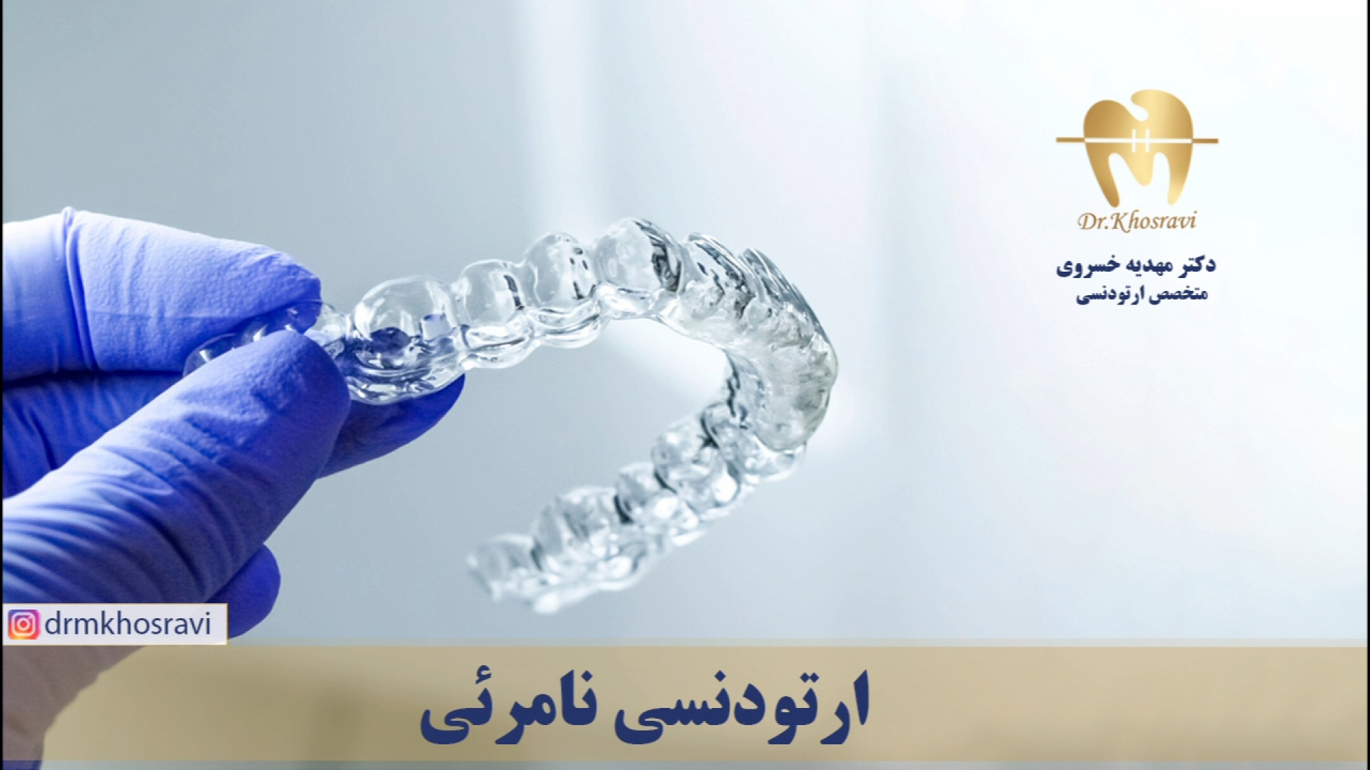 ارتودنسی نامرئی - دکتر مهدیه خسروی - متخصص ارتودنسی دکتر مهدیه خسروی - متخصص ارتودنسی