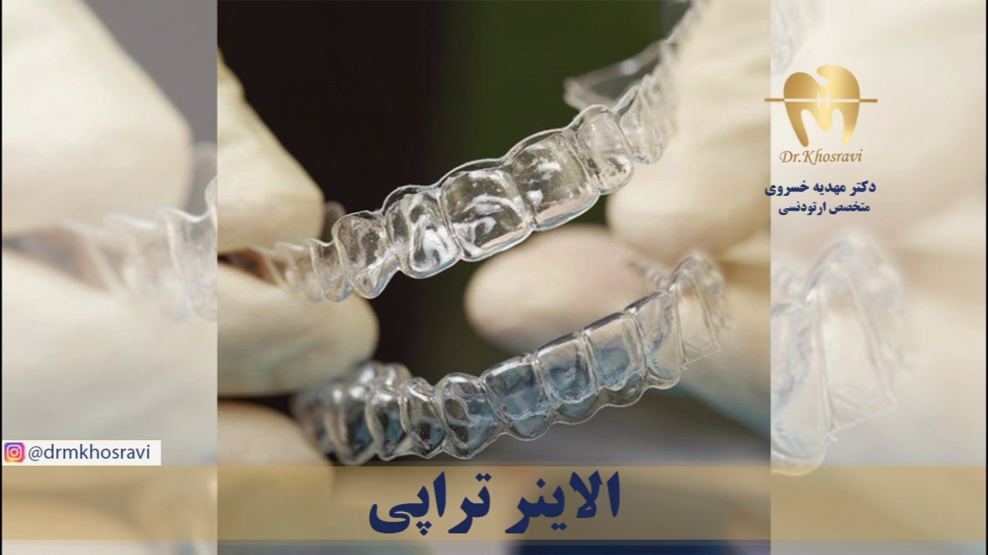 الاینر تراپی - دکتر مهدیه خسروی - متخصص ارتودنسی دکتر مهدیه خسروی - متخصص ارتودنسی