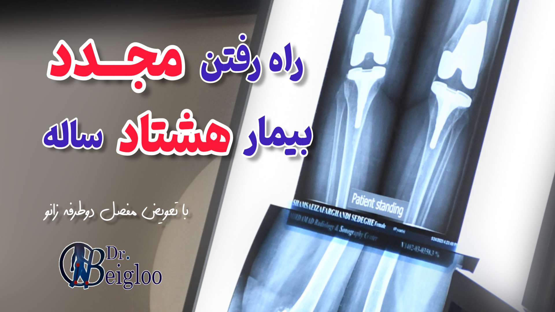 راه رفتن مجدد بیمار هشتاد ساله دکتر محمود جعفر بیگلو