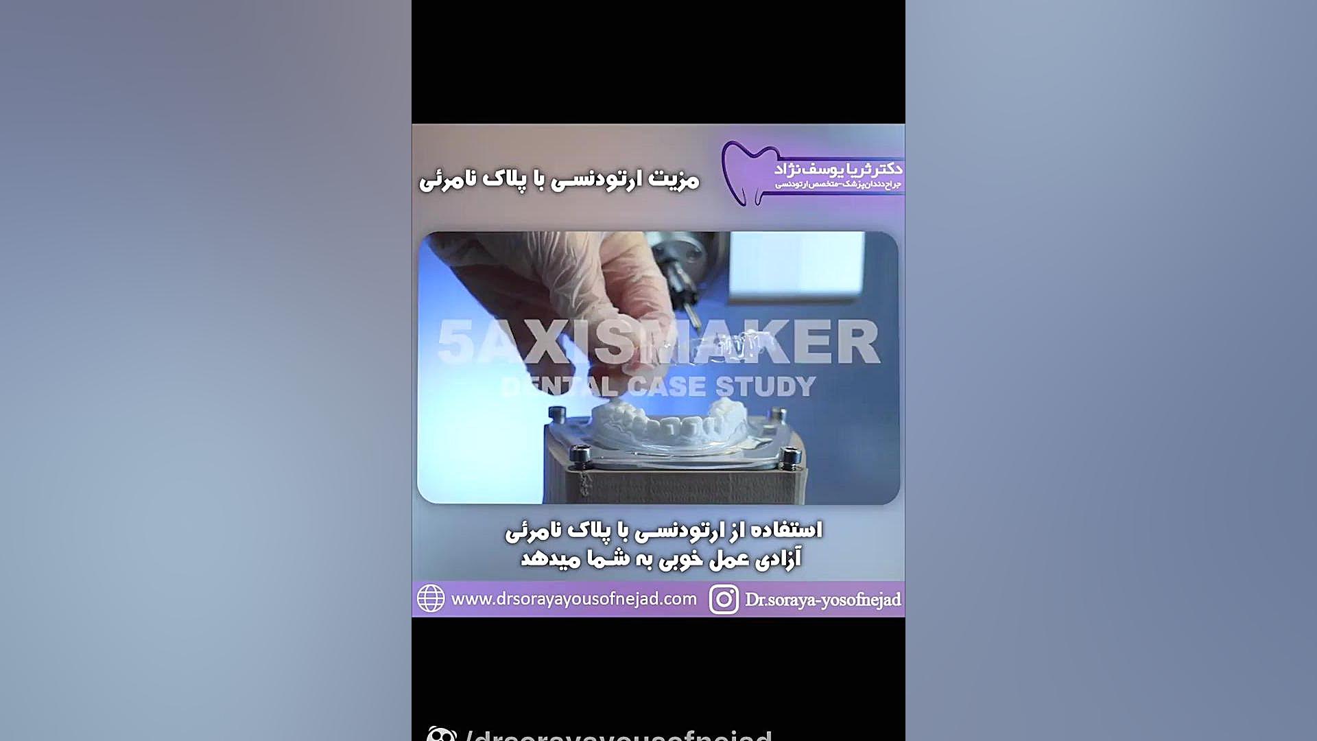 ارتودنسی با پلاک نامرئی دکتر ثریا یوسف نژاد متخصص ارتودنسی بابل