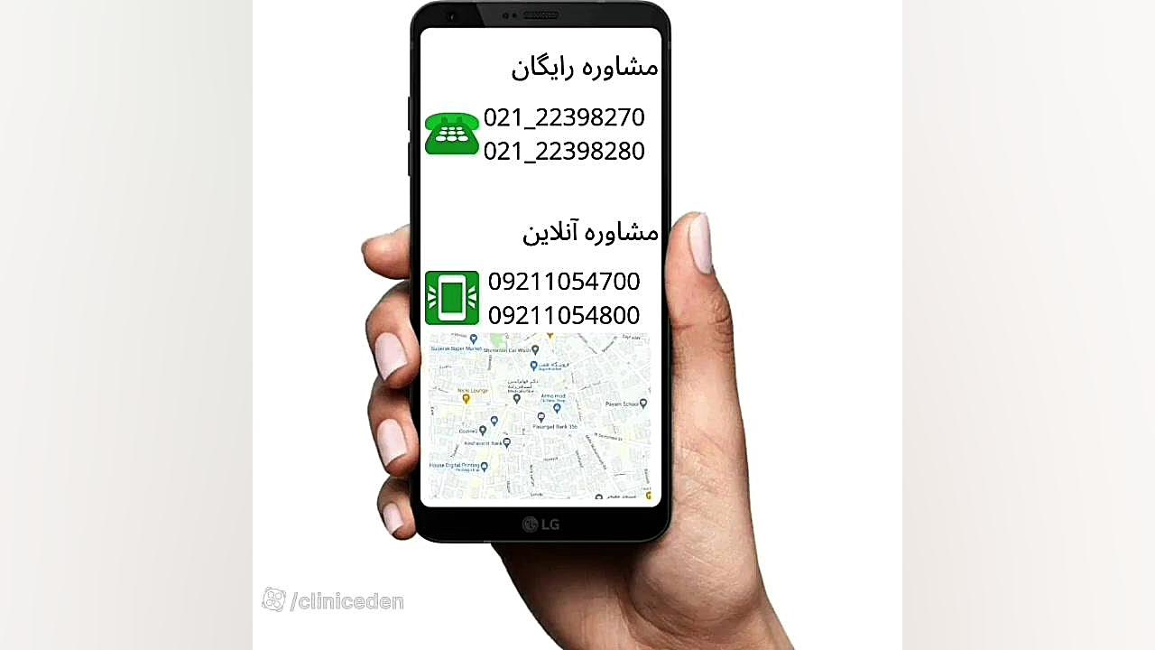 جراحی بلفاروپلاستی زاویه سازی صورت