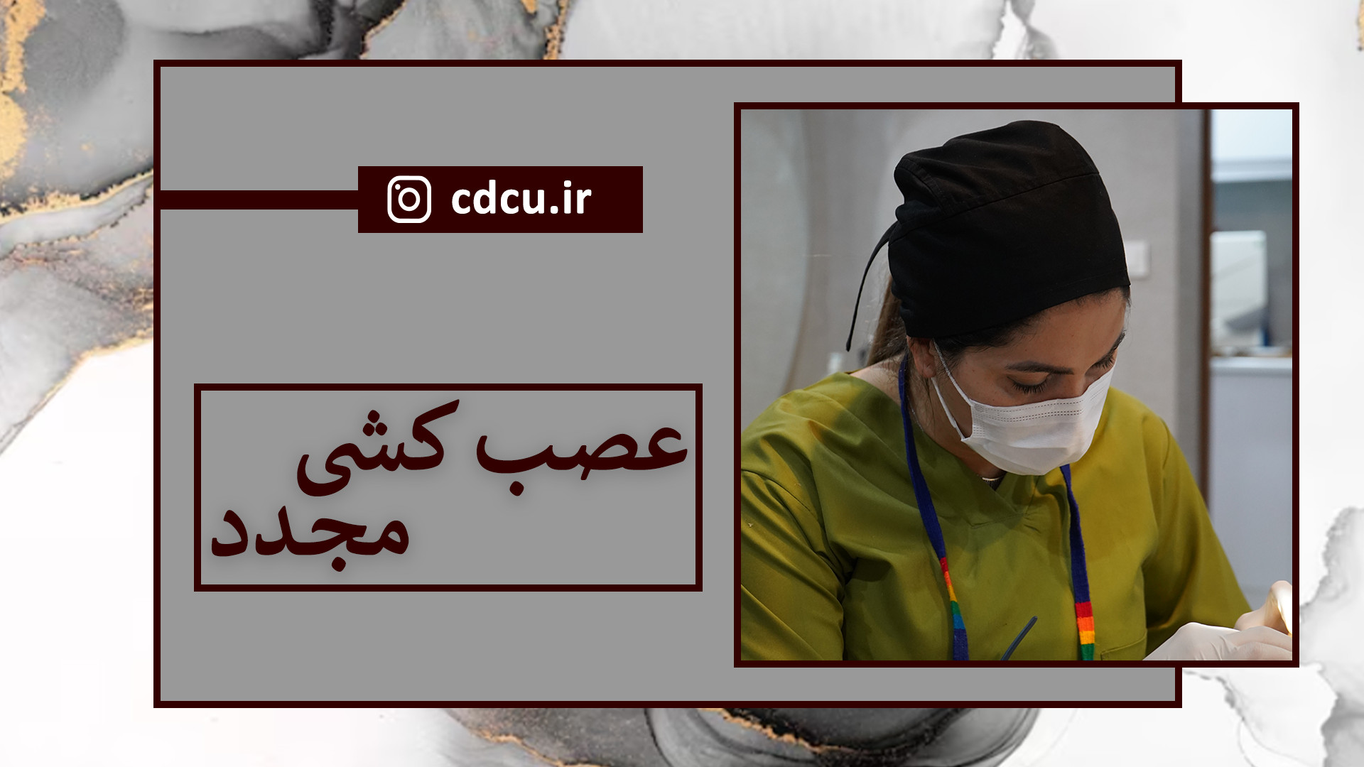 عصب کشی مجدد پادکست