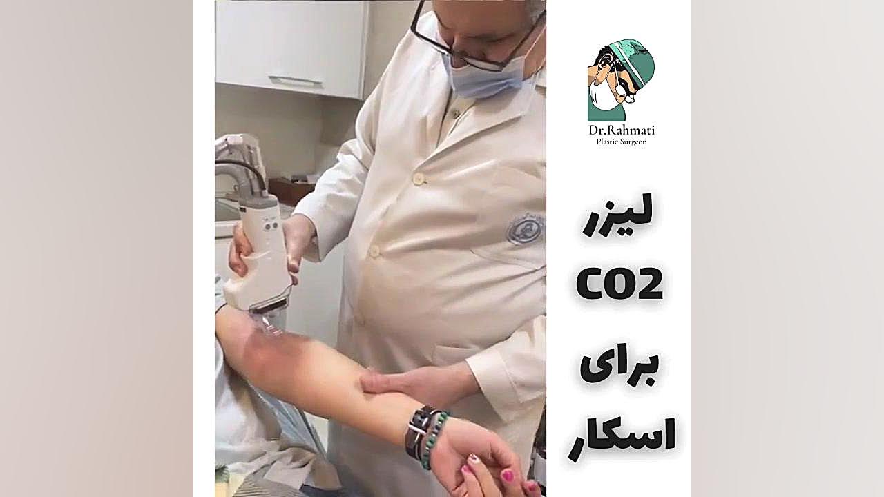 لیزر جای زخم دکتر جواد رحمتی