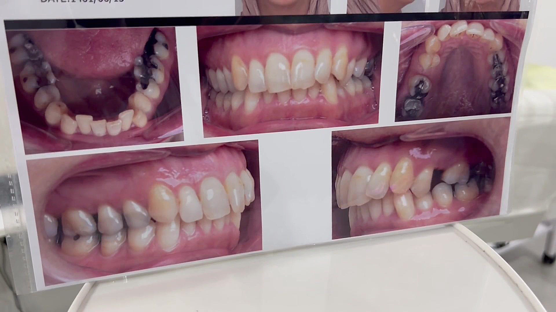 متخصص ارتودنسی در مرکز تهران دكتر مهدي فهيمي هنزائي