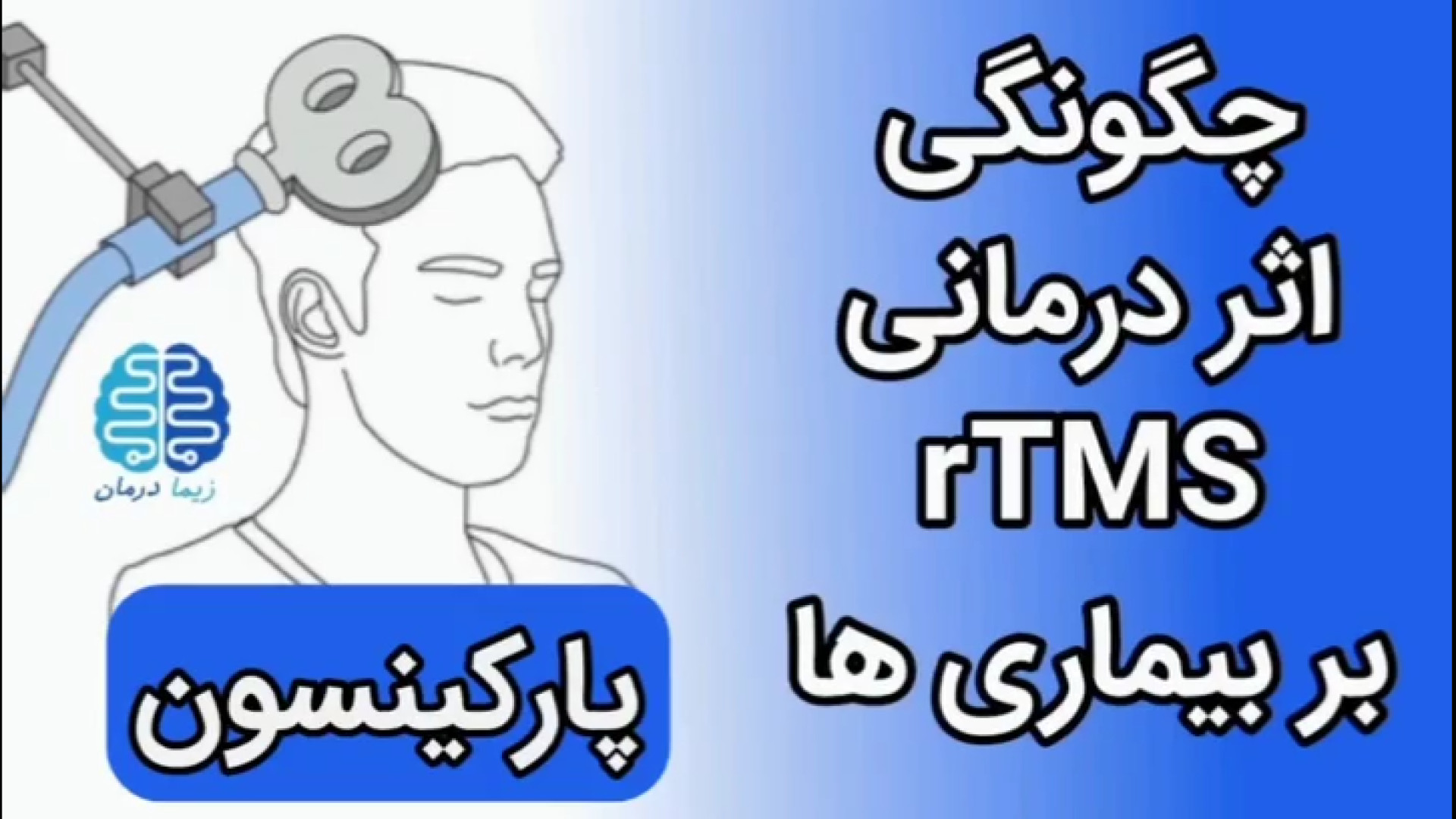 چگونه آر تی ام اس یاعث درمان پارکینسون می شود؟ کاشت ابرو