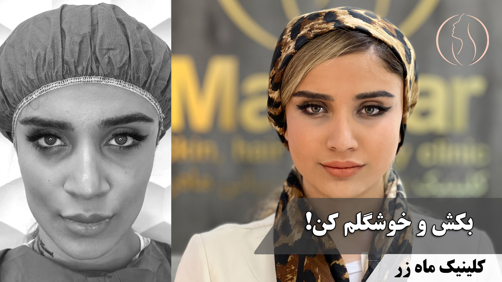 بکش و خوشگلم کن ( تزریق چربی کلینیک ماه زر ) پروتز دندان