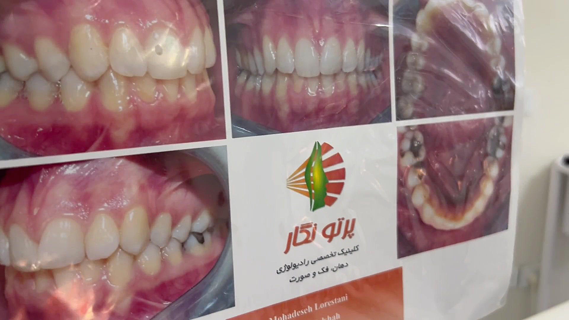 ارتودنسی دكتر مهدي فهيمي هنزائي