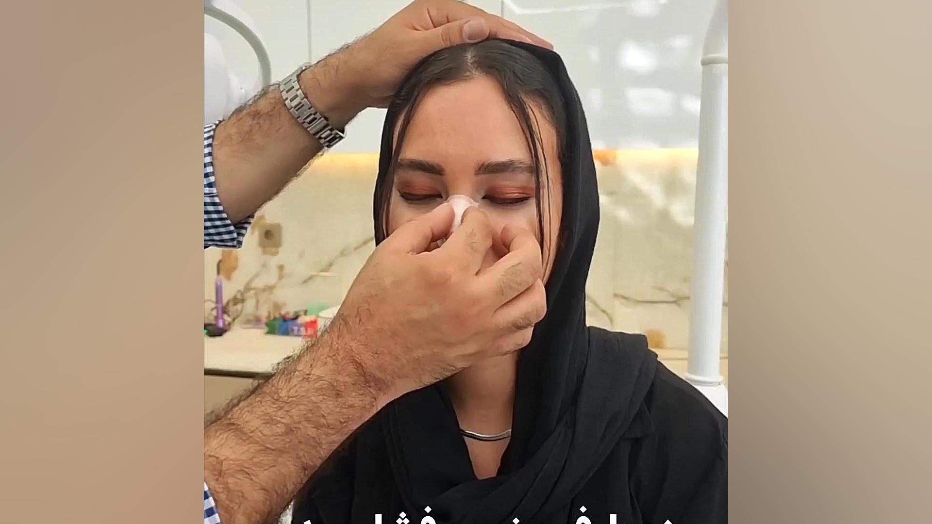 آموزش ماساژ بینی بعد از عمل دکتر علی شفیعی رونیزی | بهترین جراح بینی تهران