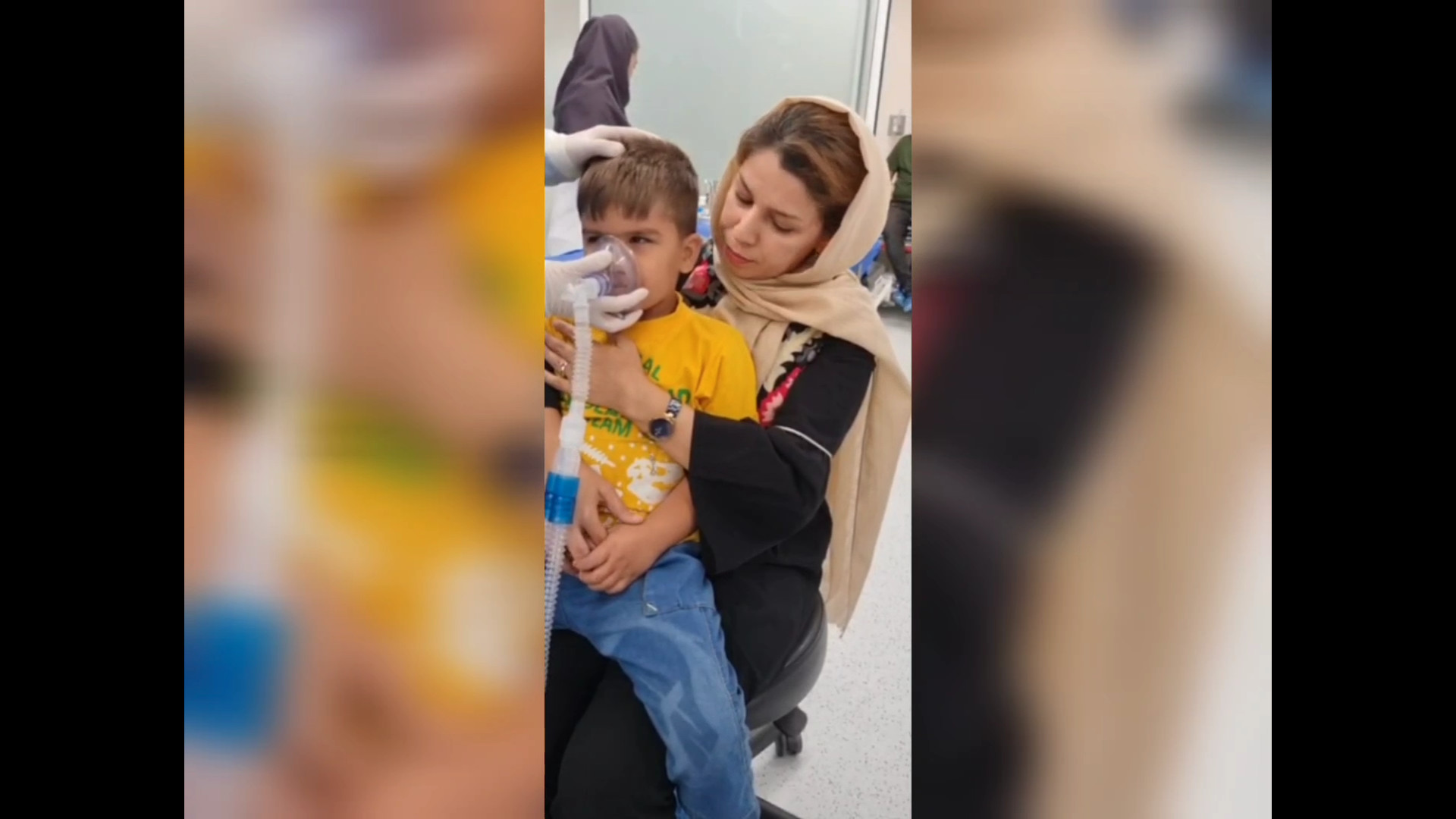 ماسک گذاری ابتدای بیهوشی جهت درمان دندانپزشکی برای کودک ابرسانی پوست