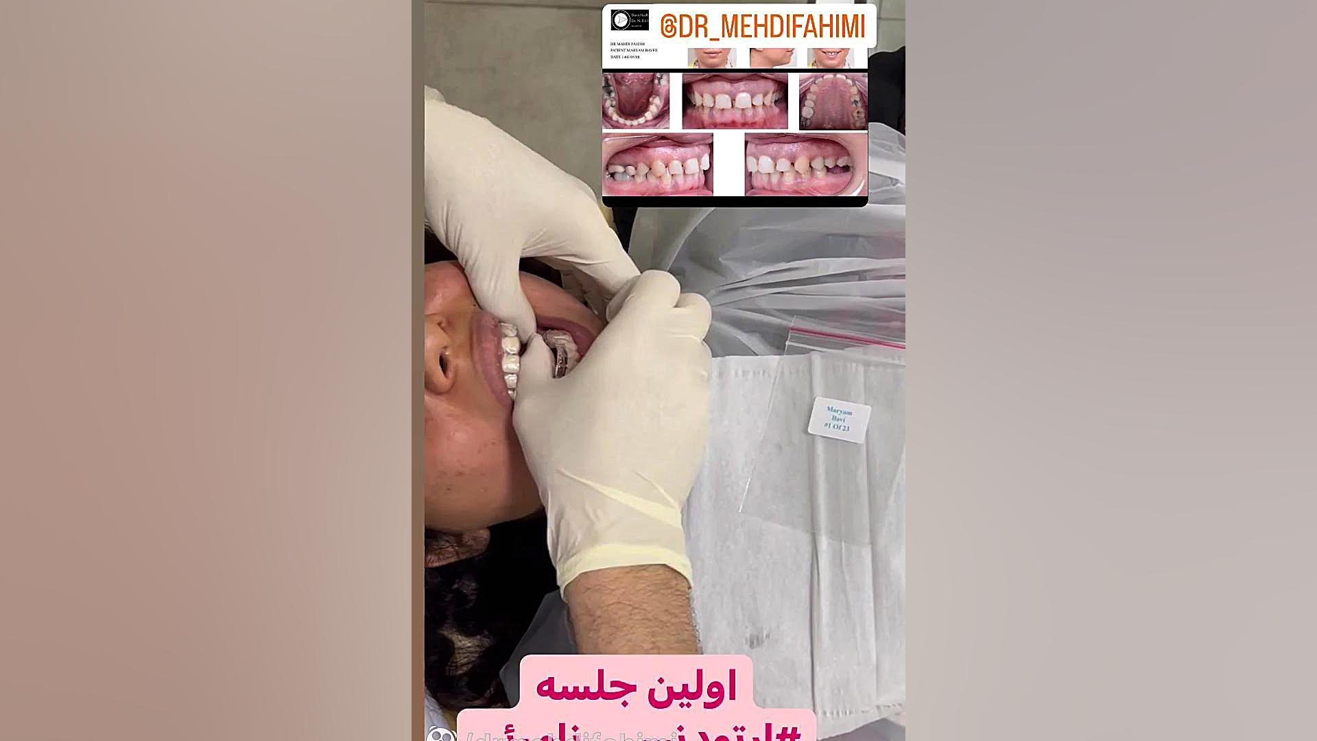 ارتودنسی نامرئی ستارخان دكتر مهدي فهيمي هنزائي