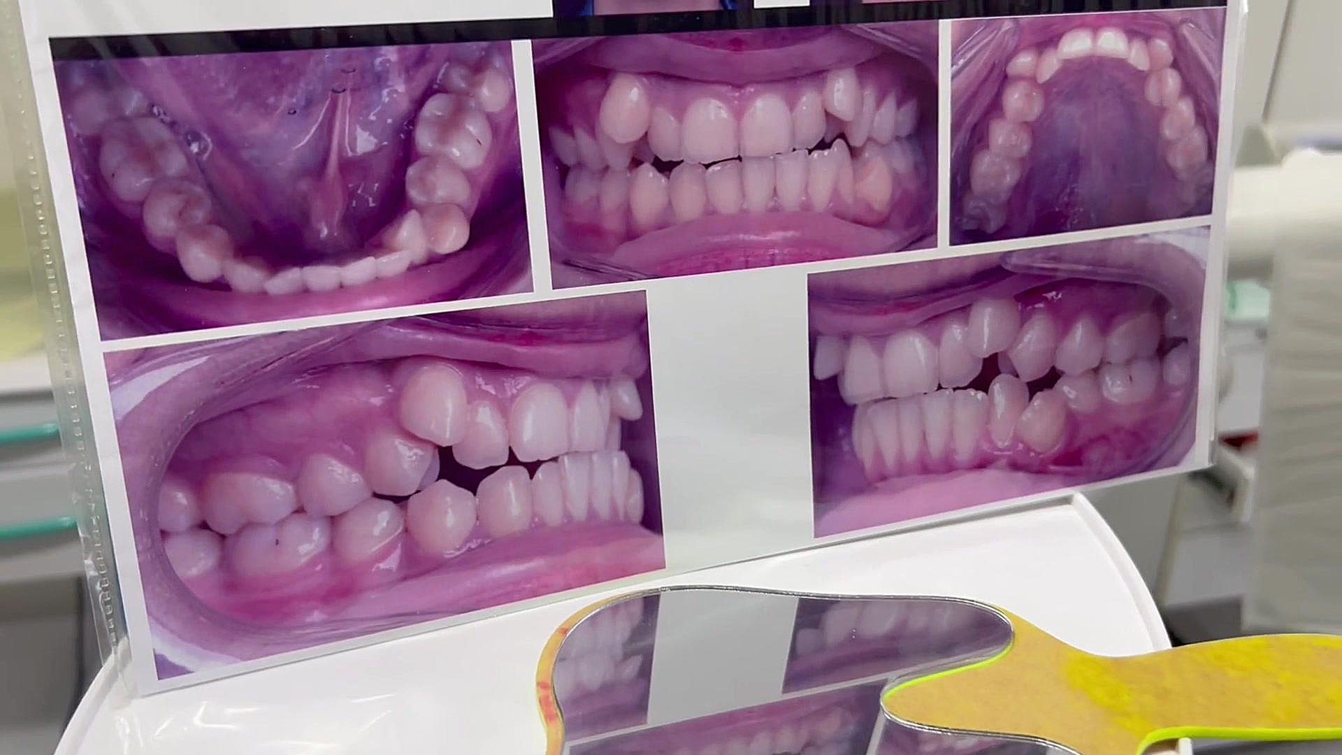 ارتودنسی سرامیکی صادقیه دكتر مهدي فهيمي هنزائي