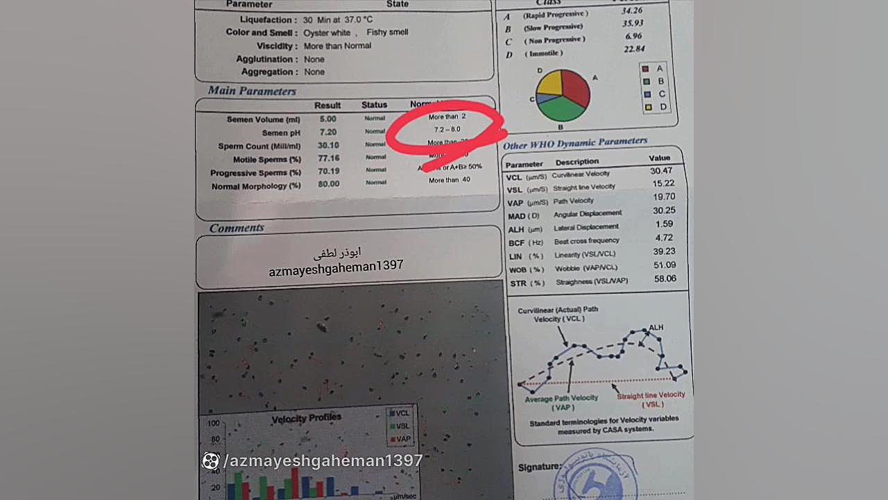 آزمایش آنالیز اسپرم دستگاه آنالیز اگزوزوم