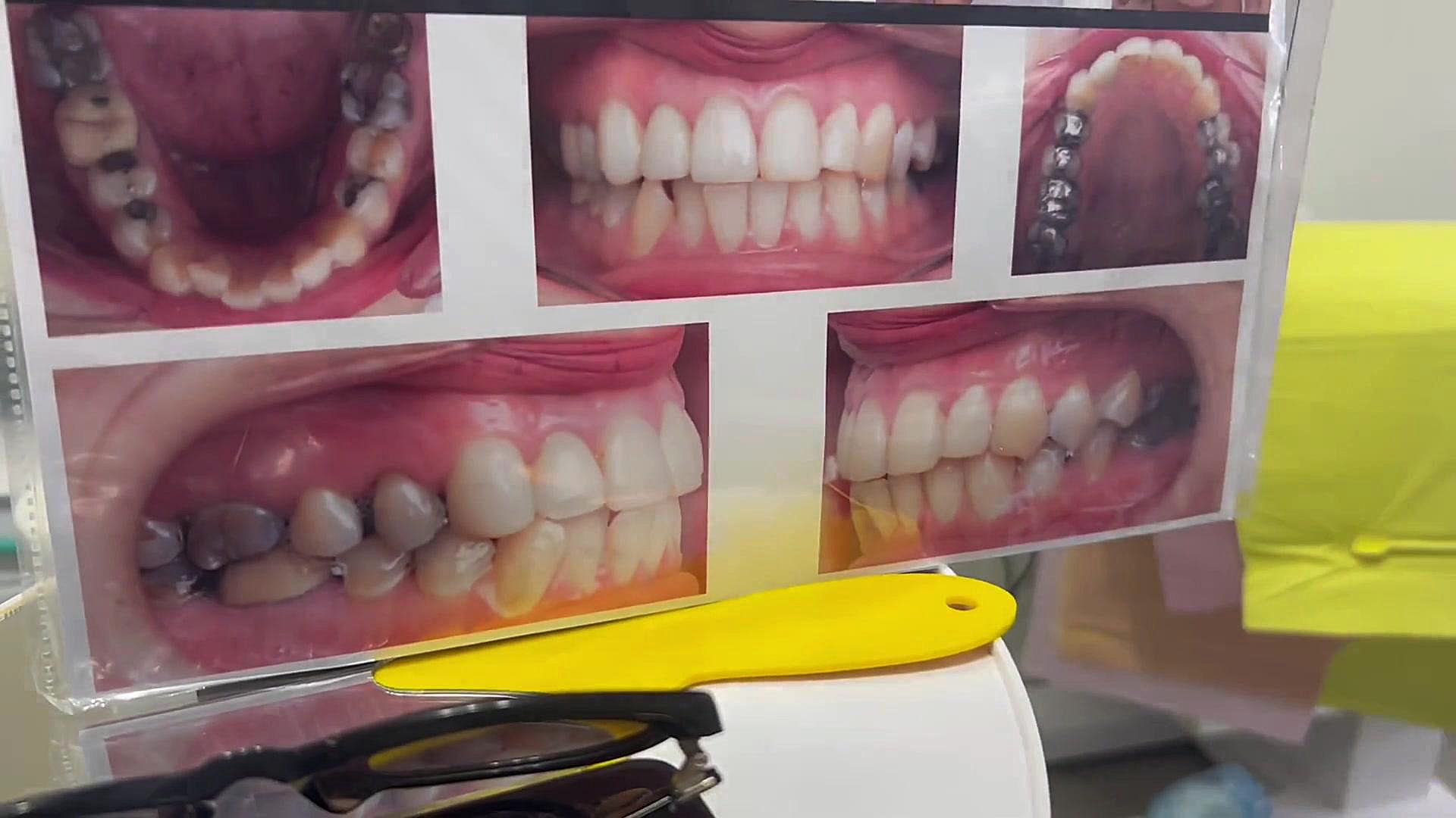 ارتودنسی تخصصی دكتر مهدي فهيمي هنزائي