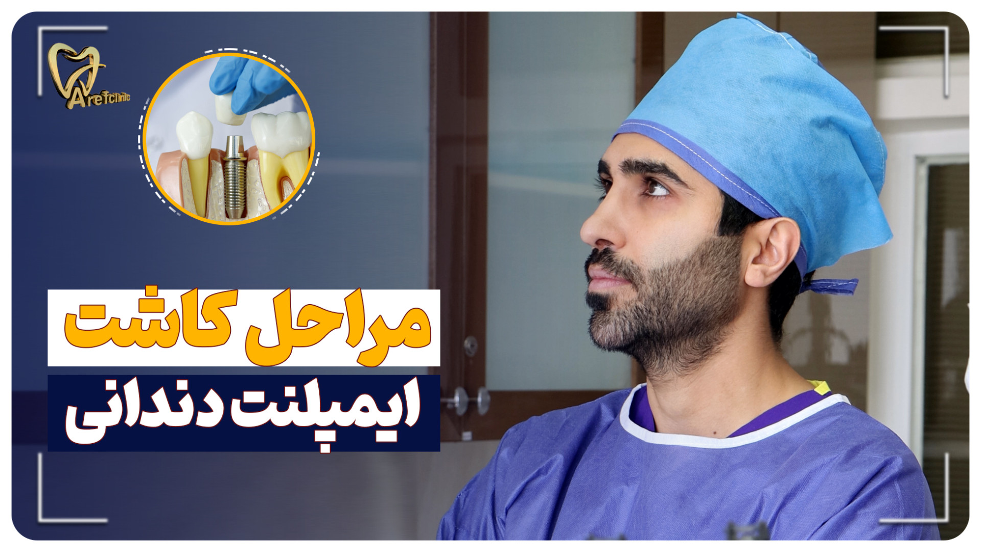 0 تا 100 مراحل ایمپلنت دندان از جراحی تا قالبگیری ریژنراتیو مدیسین