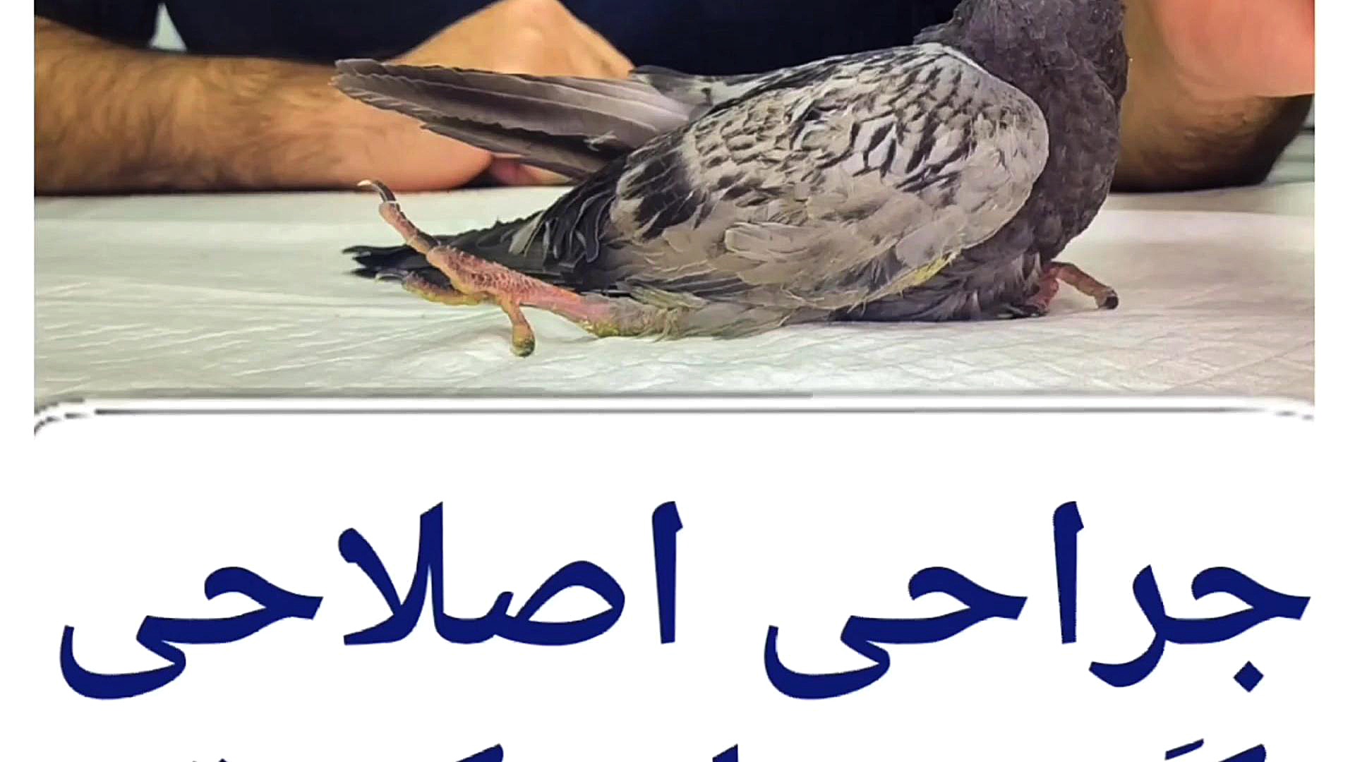 جراحی عارضه مادرزادی کجی پا در کبوتر دکتر علی برهانی کیا