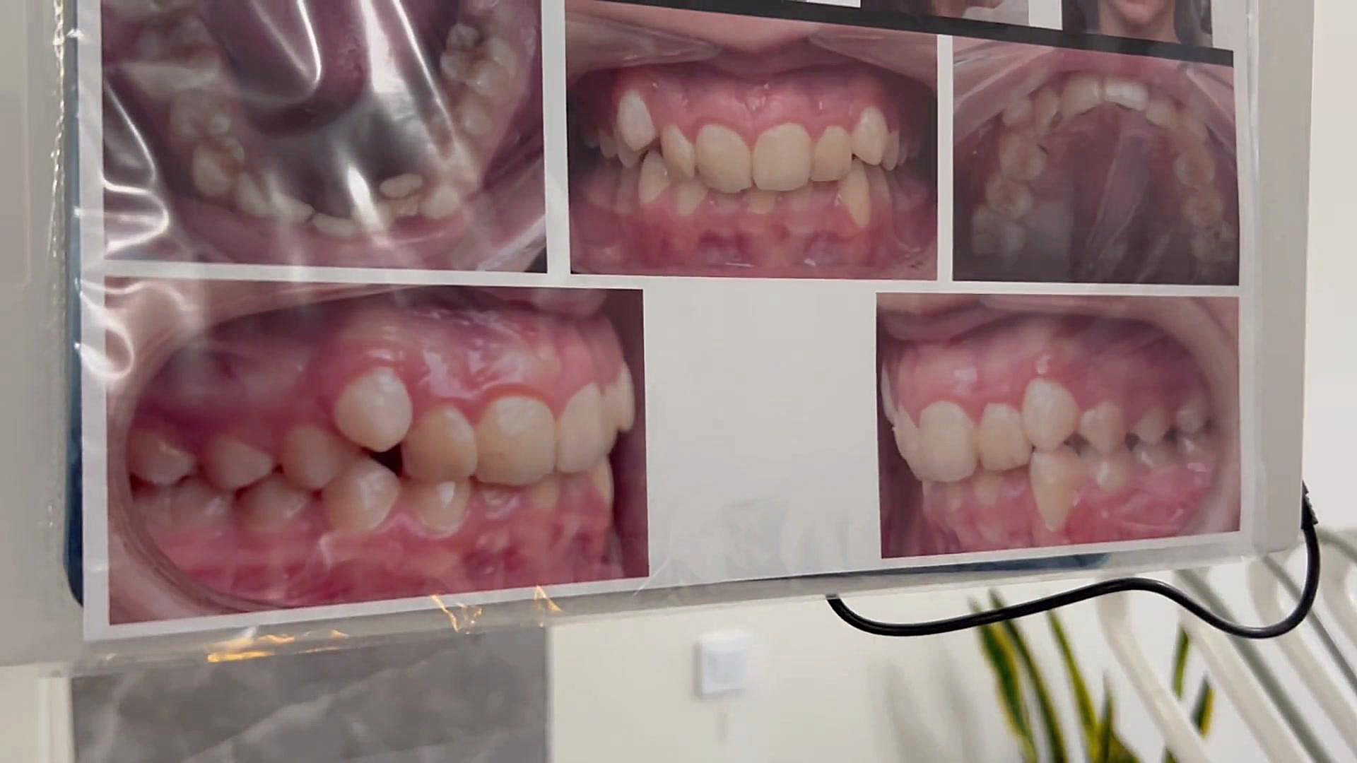 ارتودنسی کوتاه دكتر مهدي فهيمي هنزائي