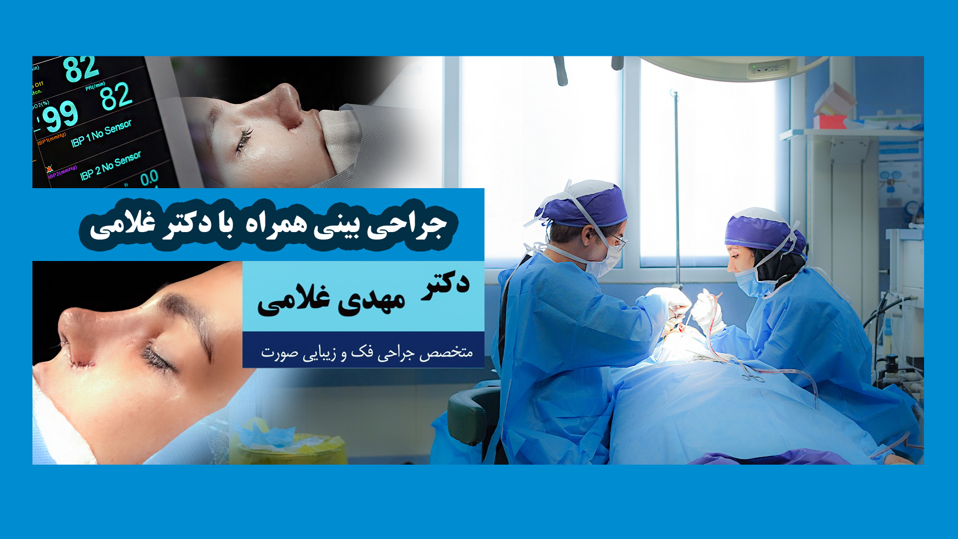 جراحی بینی همراه با دکتر مهدی غلامی در مشهد دکتر مهدی غلامی