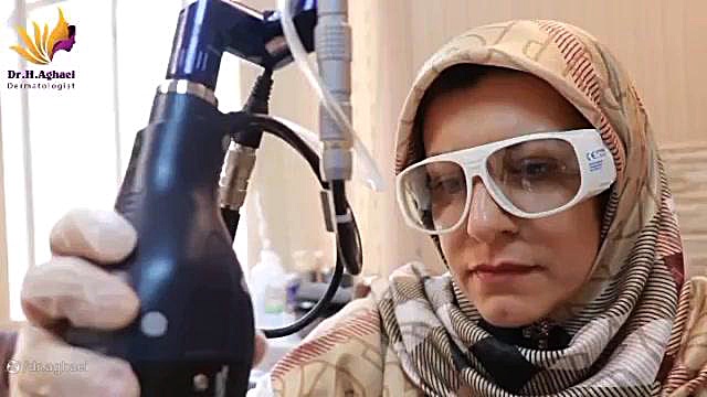 لیزر جهت رفع اسکار دکتر حمیده آقایی