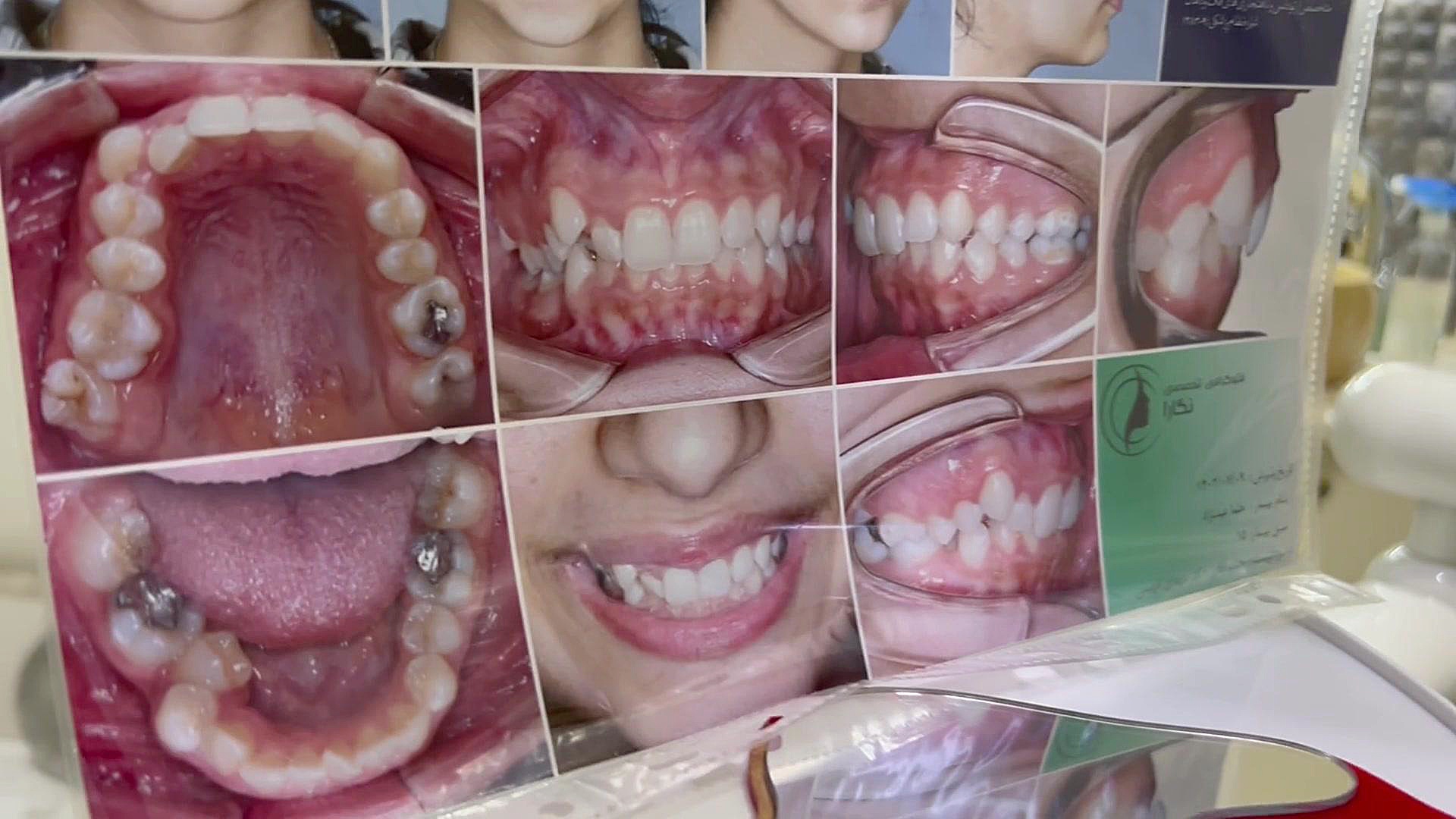 ارتودنسی با دکتر فهیمی دكتر مهدي فهيمي هنزائي