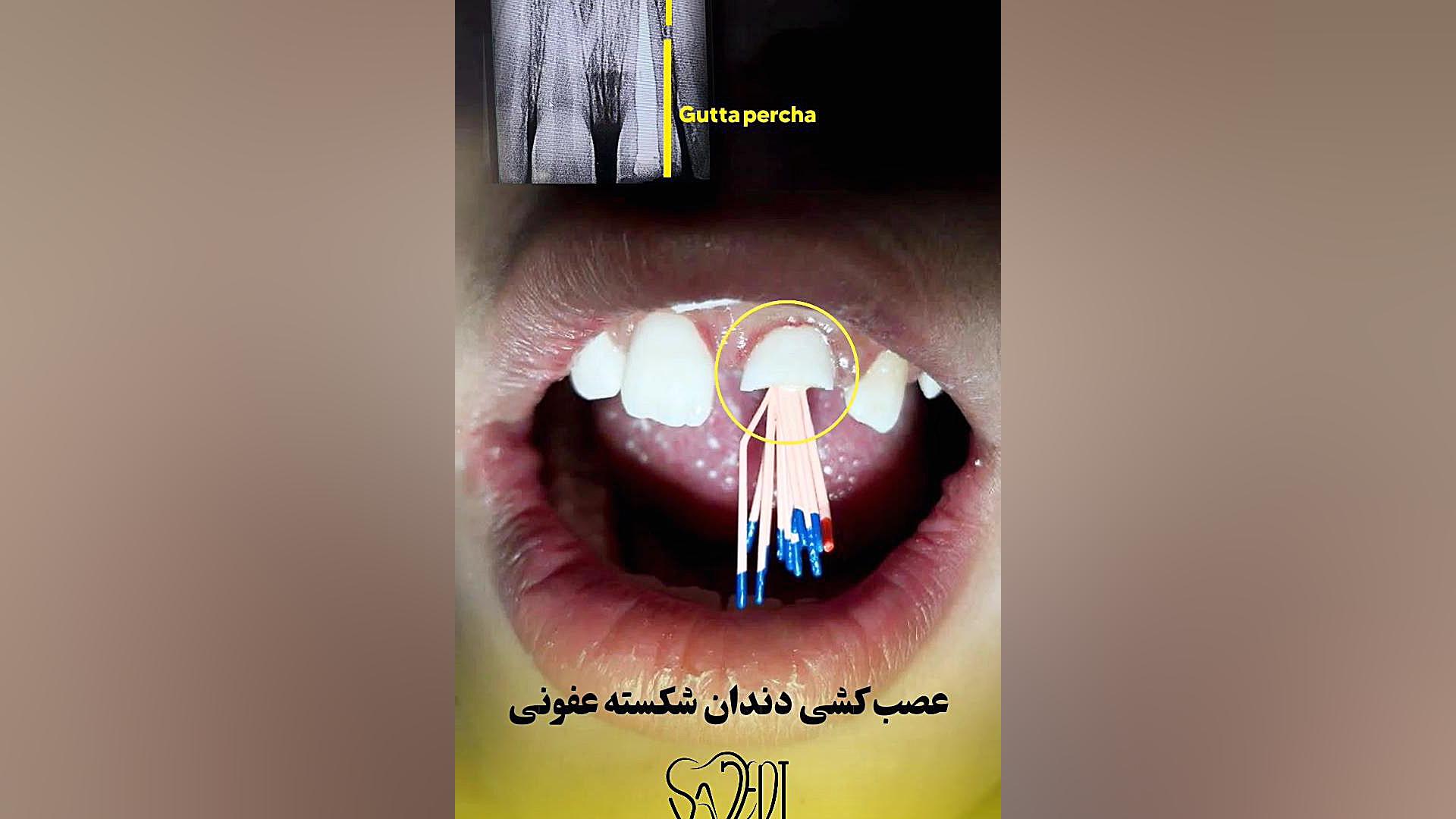 دکتر داود ساجدی جراحی بینی