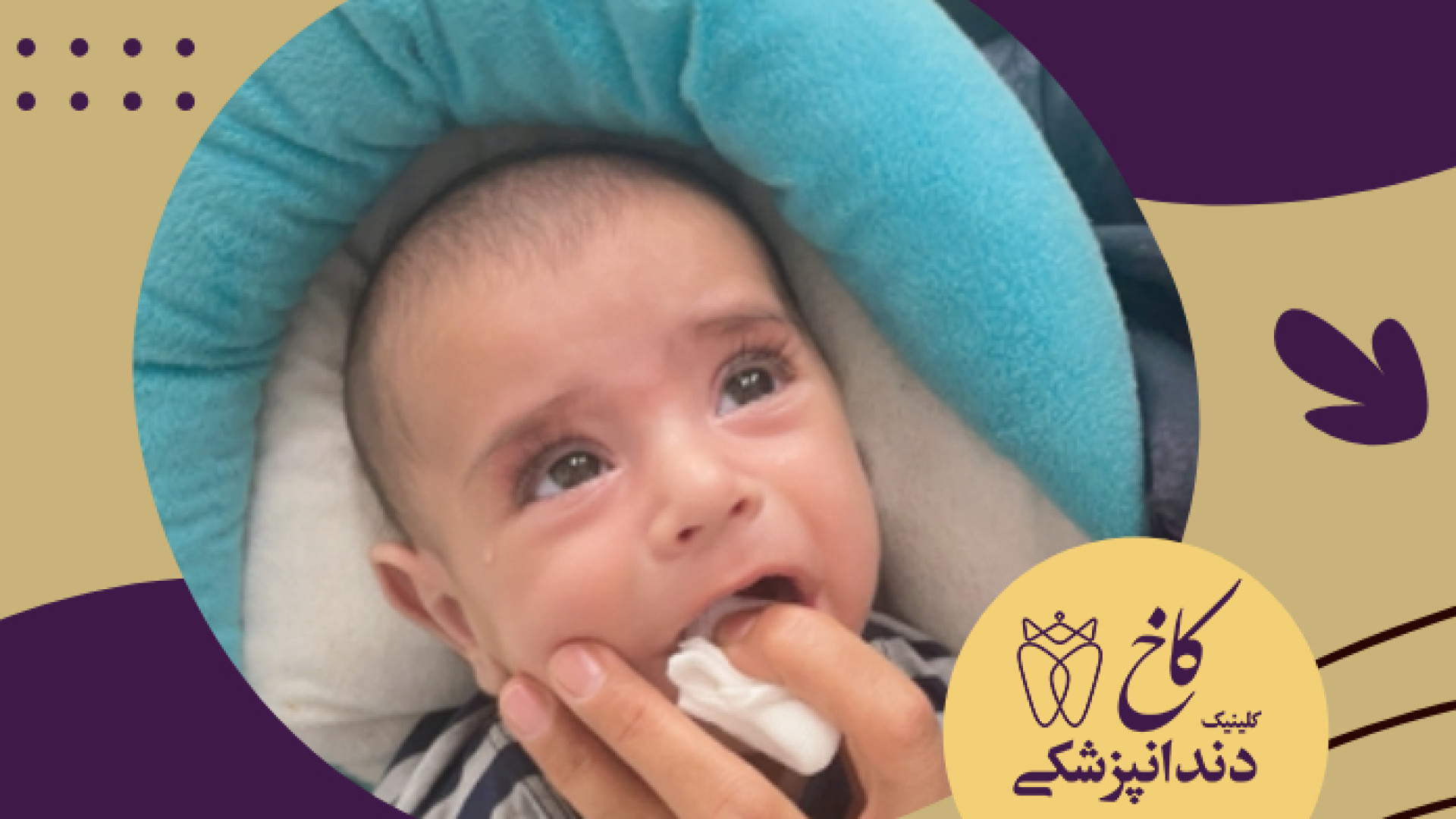 نوزادی که دندان دارد! کلینیک دندانپزشکی کاخ