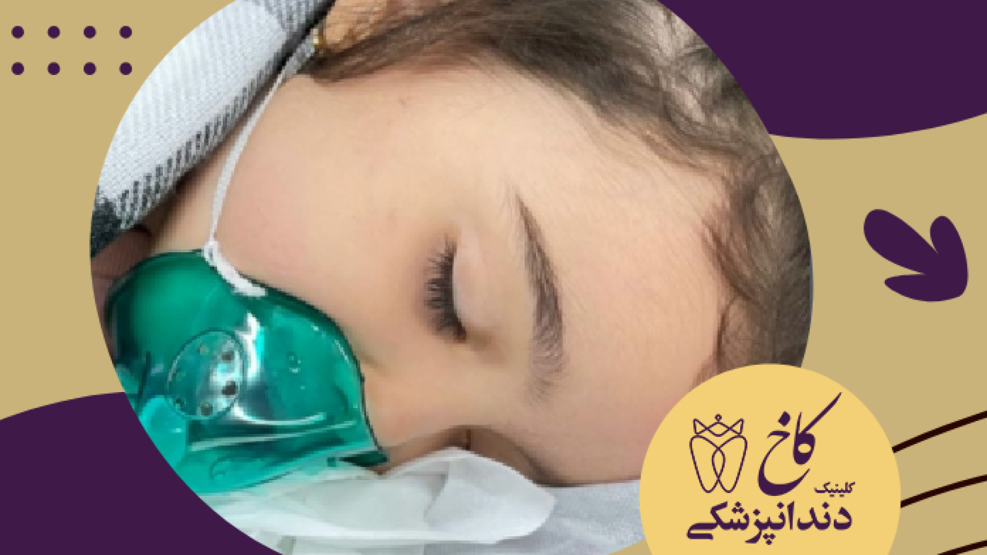 ارامش در دندانپزشکی با بیهوشی در کلینیک کاخ کلینیک دندانپزشکی کاخ