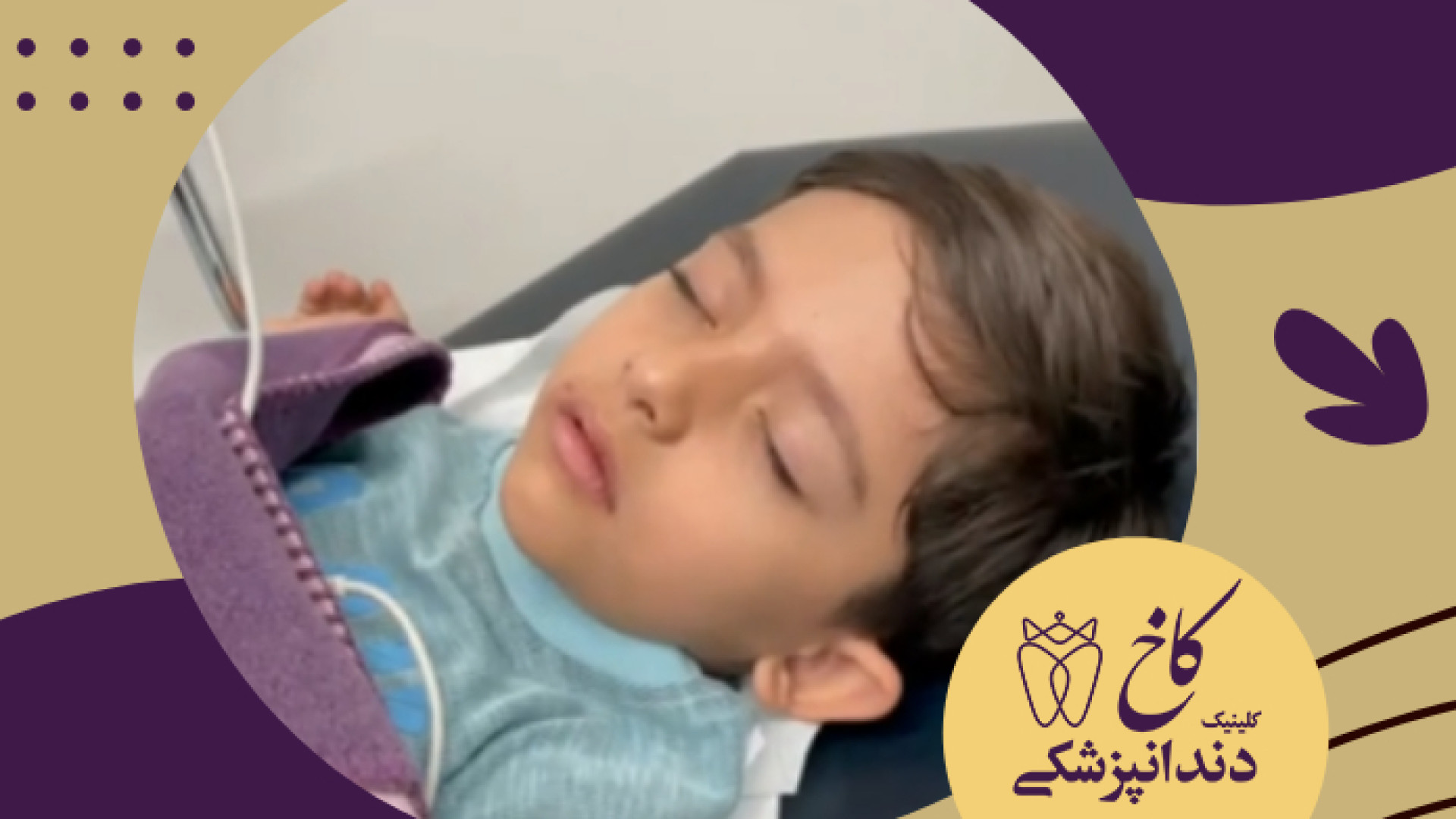 کشیدن دندان شیری با آرامبخشی کلینیک دندانپزشکی کاخ
